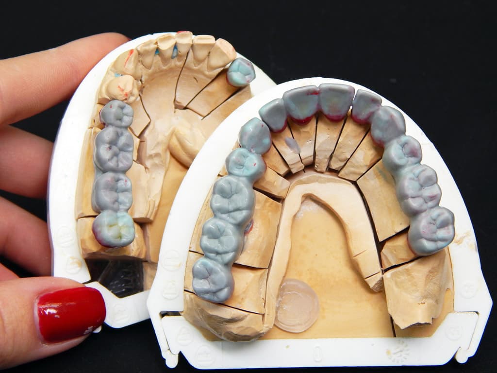 Изготовление гипсовой модели. Разборная модель в стоматологии. Моделирование зубов из керамики. Гипсовая модель зубов. Зуботехническая модель.